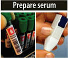 Prepare Serum